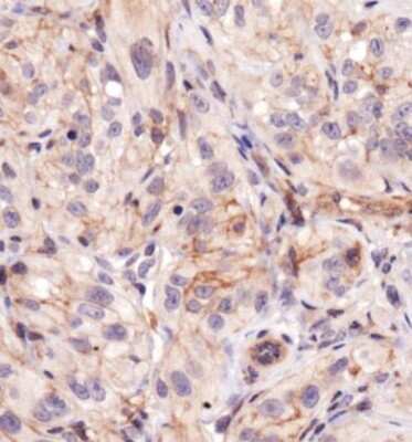 Immunohistochemistry: BTK [p Tyr223] Antibody - BSA Free [NBP1-78295]